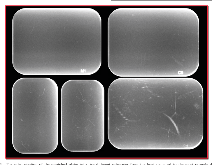 Reusable film-sized plates coated with phosphor as the image receptor.